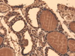 Sodium-Iodide Symporter Antibody in Immunohistochemistry (Paraffin) (IHC (P))