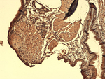Sodium-Iodide Symporter Antibody in Immunohistochemistry (Paraffin) (IHC (P))