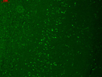 Trpm7 Monoclonal Antibody (S74)