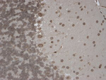 Trpm7 Antibody in Immunohistochemistry (Paraffin) (IHC (P))