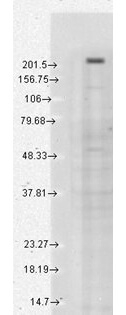 Trpm7 Antibody in Western Blot (WB)