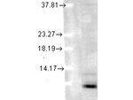 Ubiquitin Monoclonal Antibody (5B9-B3)