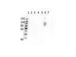 Hemoglobin beta S Monoclonal Antibody (23E5.H6.G6.C1.H7.F7.G9.F6)