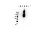 Hemoglobin beta C Monoclonal Antibody (15C2.C11.F2.G11)
