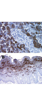 BI1 Antibody in Immunohistochemistry (Paraffin) (IHC (P))
