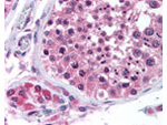 BI1 Antibody in Immunohistochemistry (Paraffin) (IHC (P))