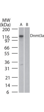 Dnmt3a Antibody in Western Blot (WB)