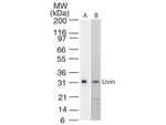 Livin Monoclonal Antibody (88C570)