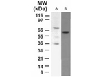 p73 Monoclonal Antibody (5B429)