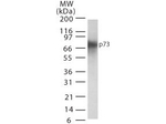 p73 Monoclonal Antibody (5B1288)