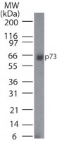 p73 Antibody in Western Blot (WB)
