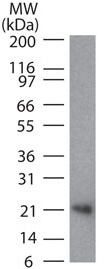 RANKL Antibody in Western Blot (WB)