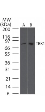 TBK1 Antibody in Western Blot (WB)