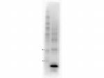 Procalcitonin Monoclonal Antibody (9G4.C3.F2)