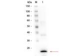 Procalcitonin Monoclonal Antibody (8G10.H3.C3.G4.E2.C8)