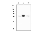 Calbindin-D Antibody in Western Blot (WB)