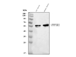 Calcineurin alpha Antibody in Western Blot (WB)