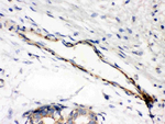Caldesmon (smooth) Antibody in Immunohistochemistry (Paraffin) (IHC (P))