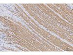 Desmin Antibody in Immunohistochemistry (Paraffin) (IHC (P))