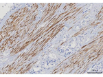 Desmin Antibody in Immunohistochemistry (Paraffin) (IHC (P))