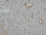 Desmin Antibody in Immunohistochemistry (Paraffin) (IHC (P))