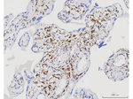 Desmin Antibody in Immunohistochemistry (Paraffin) (IHC (P))
