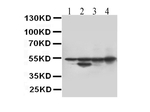 Desmin Antibody in Western Blot (WB)