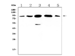 Gelsolin Antibody in Western Blot (WB)