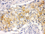 Involucrin Monoclonal Antibody (SY5)
