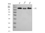 Involucrin Antibody in Western Blot (WB)