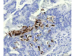 Mucin Gastric Antibody in Immunohistochemistry (Paraffin) (IHC (P))