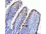 Mucin Gastric Antibody in Immunohistochemistry (Paraffin) (IHC (P))