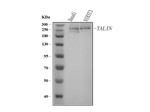 Talin Monoclonal Antibody (8d4)