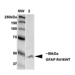 GFAP R416WT Antibody in Western Blot (WB)