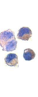 ADAM10 Antibody in Immunocytochemistry (ICC/IF)