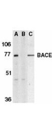 Beta-Site App-Cleaving Enzyme Antibody in Western Blot (WB)