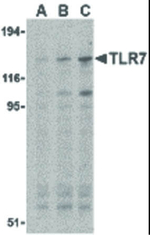 TLR7 Antibody in Western Blot (WB)