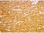 TIRAP Antibody in Immunohistochemistry (Paraffin) (IHC (P))