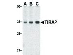 TIRAP Antibody in Western Blot (WB)