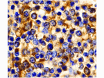 CCR3 Antibody in Immunohistochemistry (Paraffin) (IHC (P))