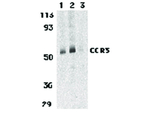 CCR3 Antibody in Western Blot (WB)
