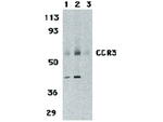 CCR3 Polyclonal Antibody