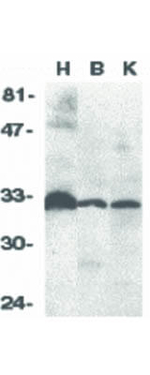 DcR3 Antibody in Western Blot (WB)