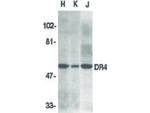 DR4 Polyclonal Antibody