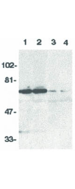 DR6 Polyclonal Antibody