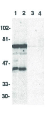 DRAK2 Antibody in Western Blot (WB)