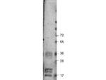 VEGF-A Polyclonal Antibody
