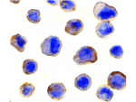 MADD Antibody in Immunohistochemistry (Paraffin) (IHC (P))