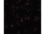 NALP1 Antibody in Immunocytochemistry (ICC/IF)