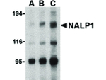 NALP1 Antibody in Western Blot (WB)